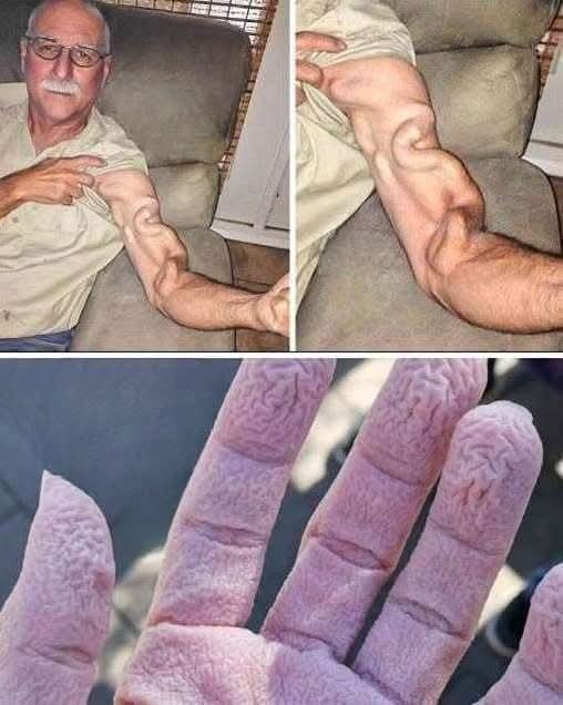😨 Fue a estirarse y terminó descubriendo algo aterrador en su cuerpo