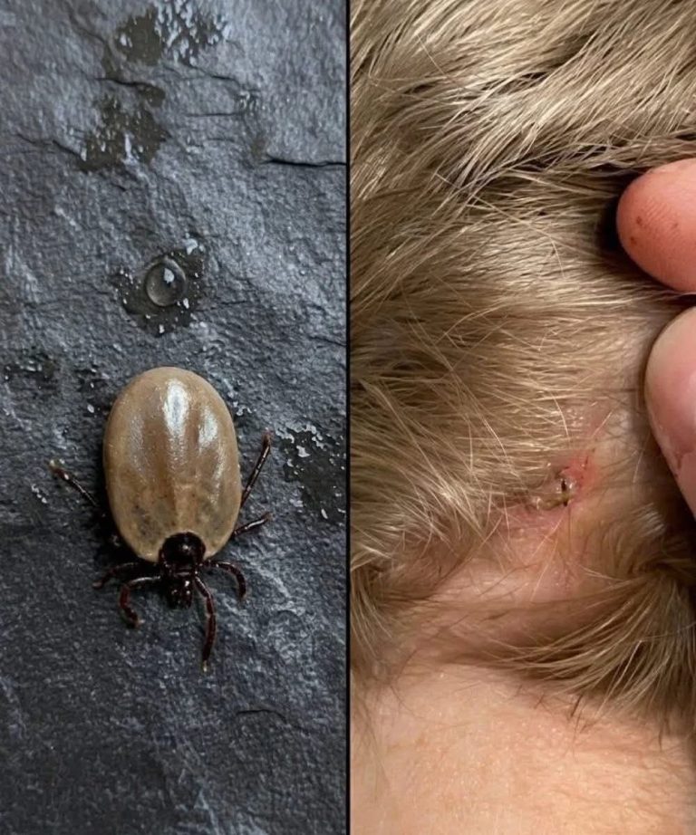 😨 Encontró este extraño insecto en la cabeza de su hijo y las redes quedaron alarmadas