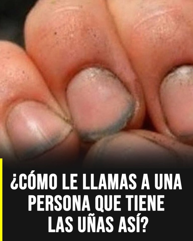 😳 Uñas descuidadas: lo que realmente podrían revelar sobre una persona