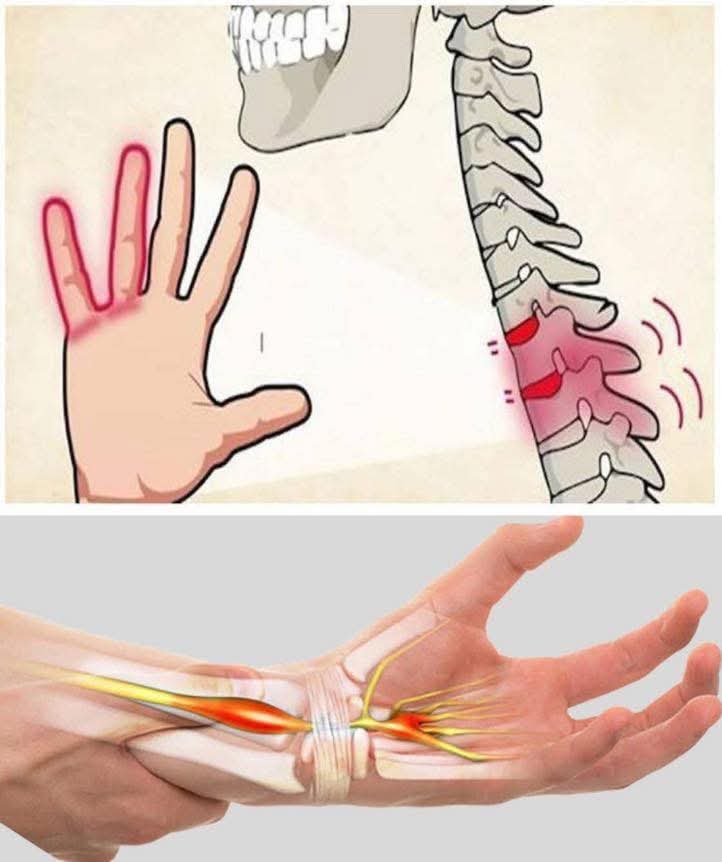 ⚠️😨 ¿Se te duermen las manos? Esto es lo que podría estar pasando en tu cuerpo