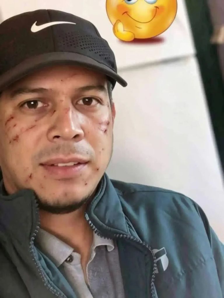 😳 Le regaló hielo a una vecina y terminó con el rostro lleno de arañazos: la historia que está causando debate