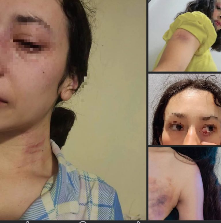 Mujer denuncia presunta violencia por parte de su expareja y pide ayuda para protegerse junto a sus hijos