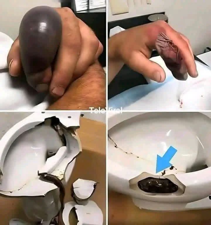 😱 Entró al baño como cualquier día… pero debajo del inodoro se escondía algo que pudo costarle la vida