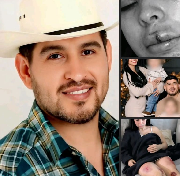 Sobreviviente denuncia brutal agresión por parte de su expareja en Dallas: “pensé que no iba a salir con vida”
