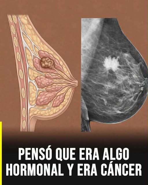 Cáncer de mama: señales tempranas que muchas personas pasan por alto