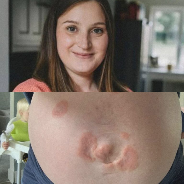 Su cuerpo rechazó a su propio bebé: la rara enfermedad que convirtió su embarazo en una pesadilla