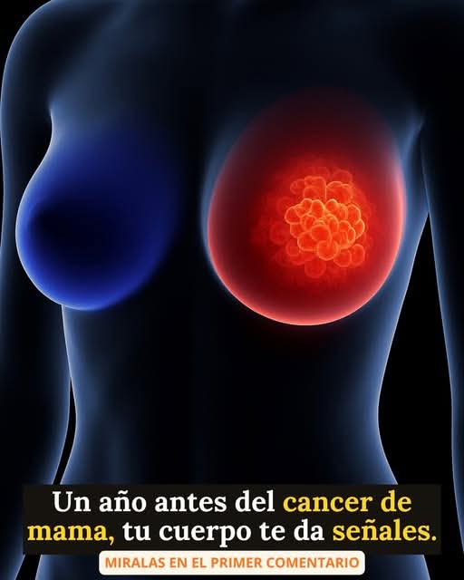 4 signos tempranos del cáncer de mama que no debes ignorar