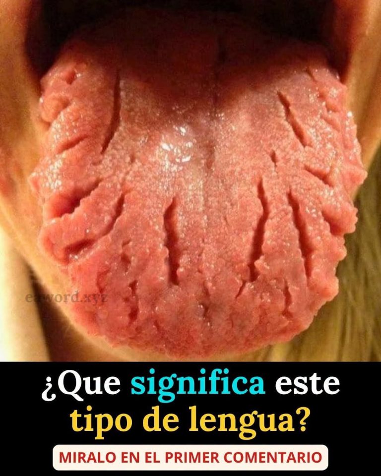 Qué significa tener la lengua con grietas y cuándo debes consultar a un especialista
