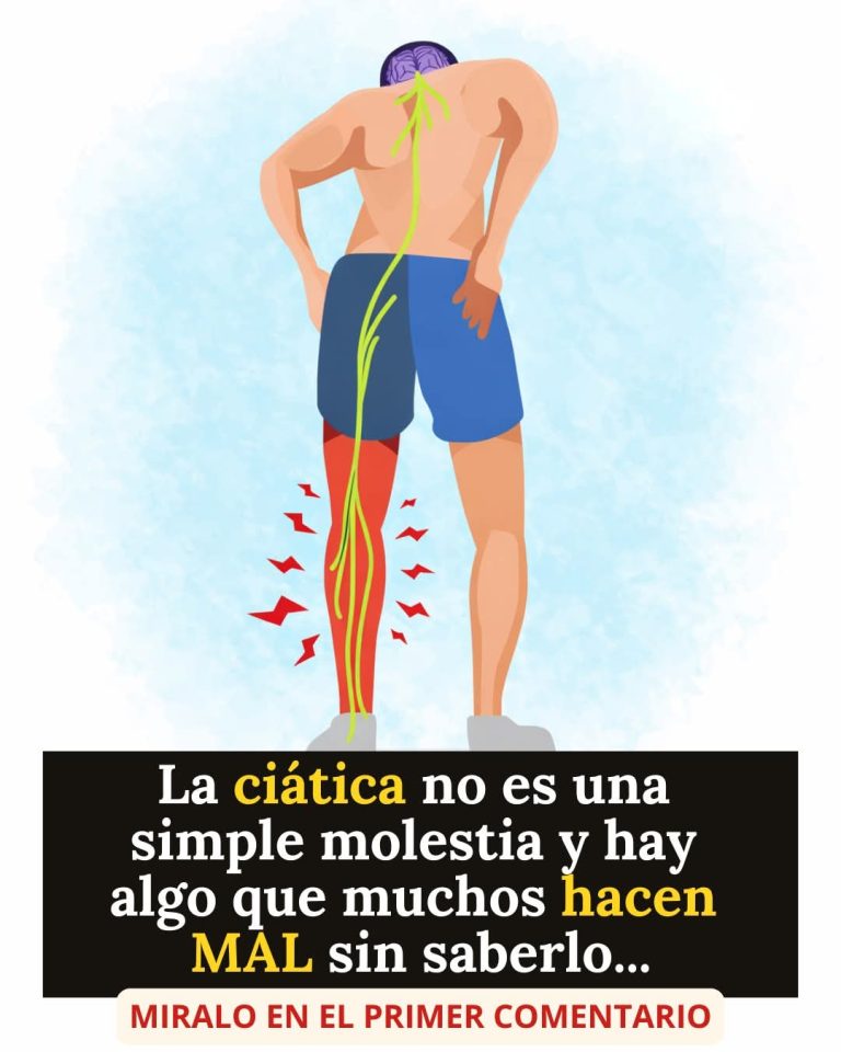 Ciática: cómo aliviar el dolor y qué errores debes evitar para no empeorar
