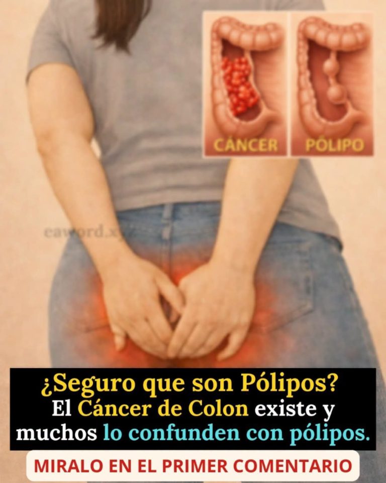 Cáncer de colon: señales silenciosas que muchas personas confunden con pólipos o problemas comunes