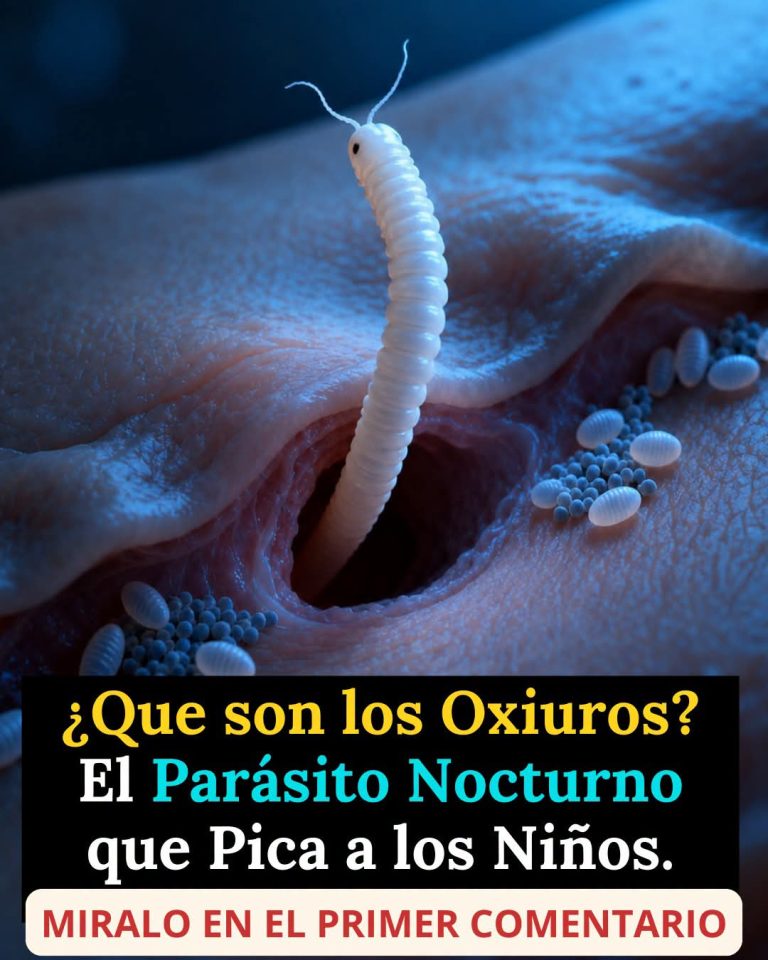 Oxiuros: el parásito intestinal que aparece principalmente durante la noche y afecta con frecuencia a los niños