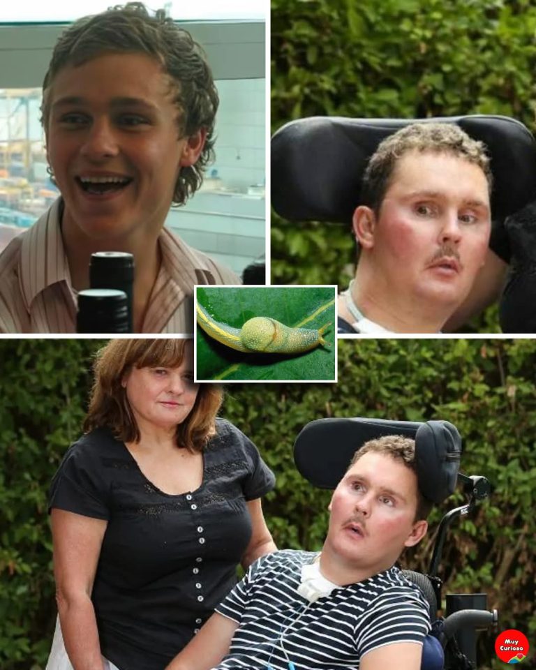 La historia de Sam Ballard: el joven cuya vida cambió tras ingerir una babosa durante un reto