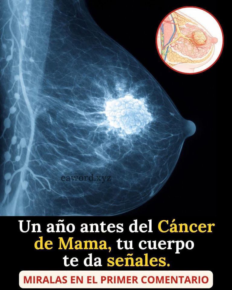 Signos tempranos del cáncer de mama que nunca debes ignorar: cómo reconocer las primeras señales y cuándo acudir al médico