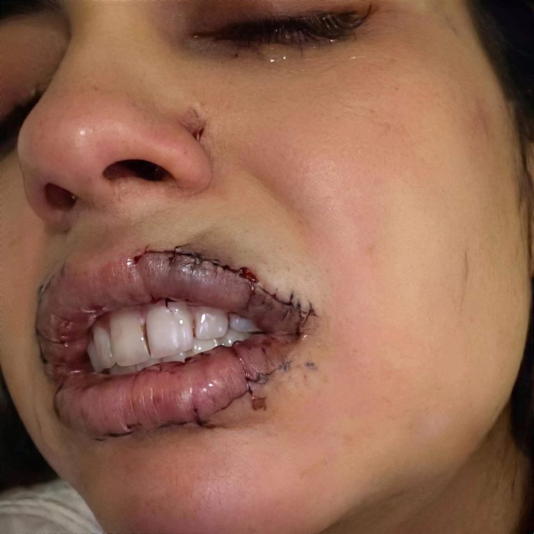 Imagen viral de una persona con lesiones faciales genera miles de reacciones en redes sociales, pero aún no existe información oficial que explique el caso
